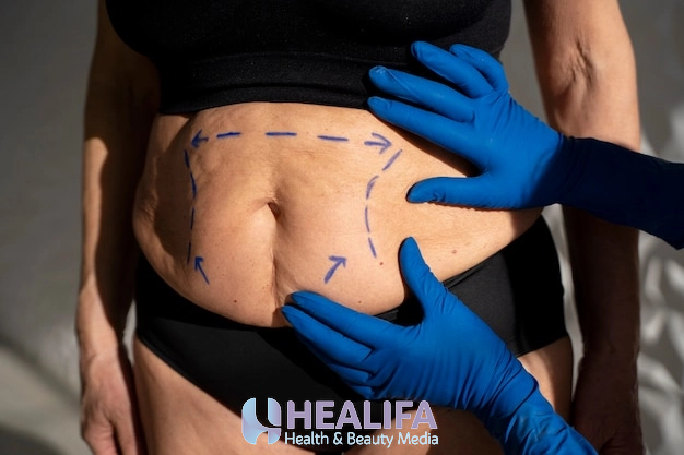 مراقبت بعد از پیکرتراشی برای کاهش تورم و ترمیم سریع‌تر