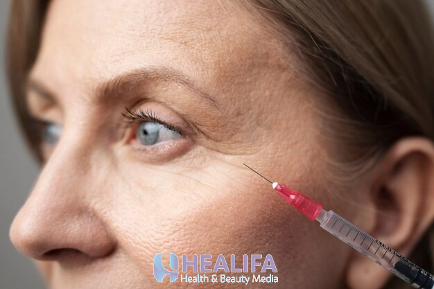 تزریق ژل زیر چشم روشی برای رفع گودی و تیرگی ماندگار